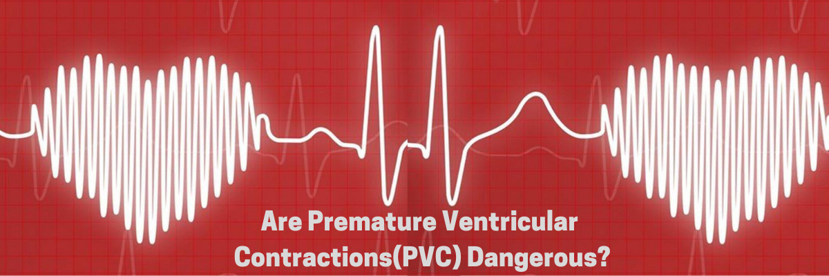Premature Ventricular Contractions