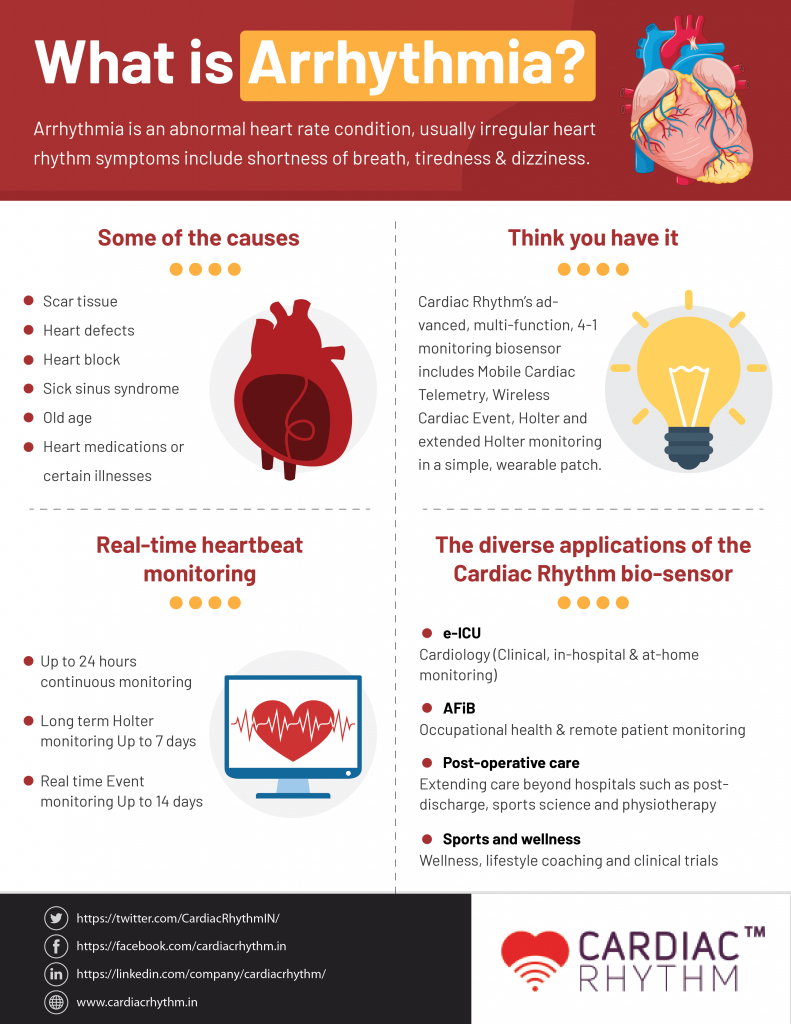 What Is Arrhythmia what-is-arrhythmia