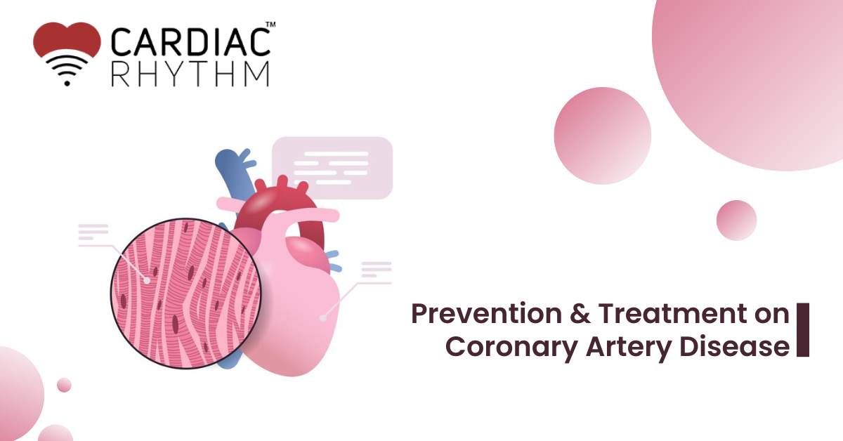 Coronary Artery Disease