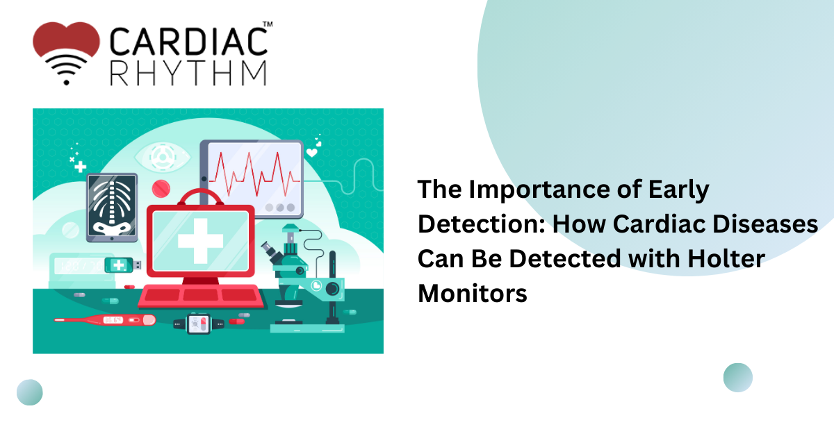 Holter Monitor